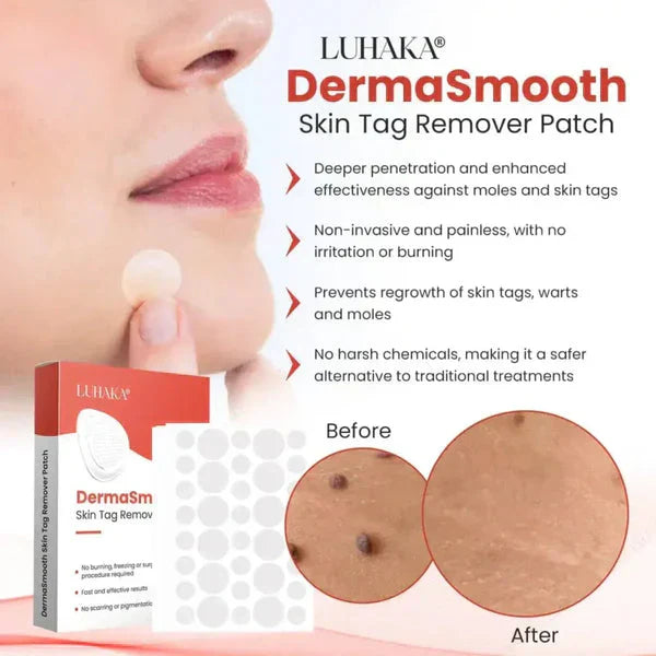 DermaSmooth Skin Tag Remover Patch