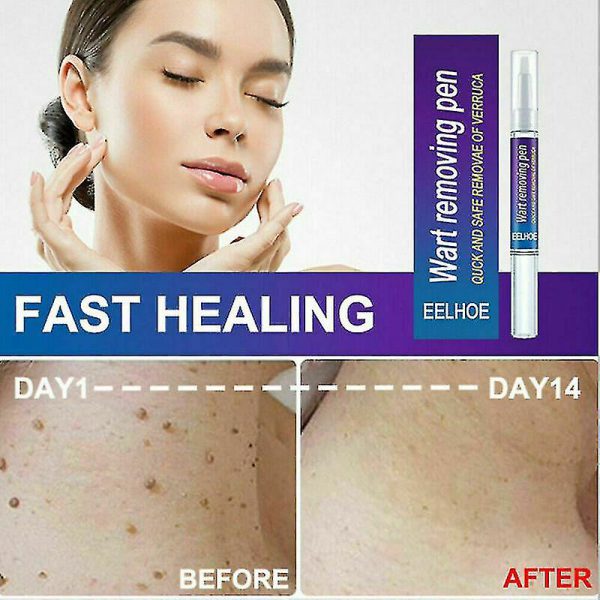 Warts Remover Original Cream